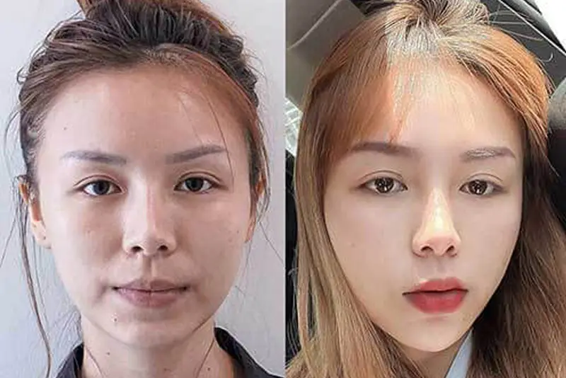 Một vài câu hỏi khách hàng thường tự hỏi — câu trả lời ngắn và thực tế