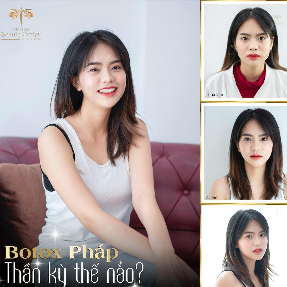 Những lưu ý trước khi tiêm