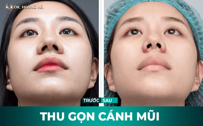 Vấn đề giấy phép, chất lượng và làm sao chọn nơi tiêm an toàn?