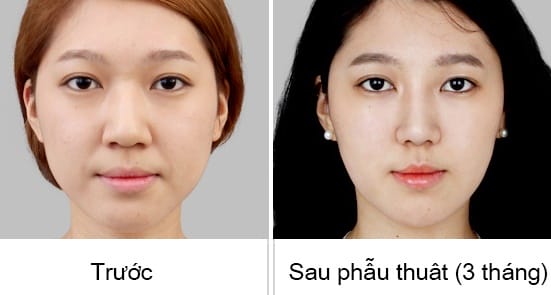 Những câu hỏi thường gặp