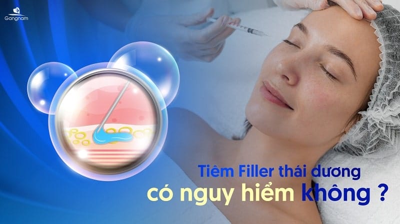 Sau tiêm cần chăm sóc thế nào và theo dõi trong bao lâu?
