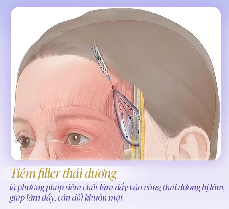 Gây tê bề mặt có đủ không hay cần gây tê vùng?