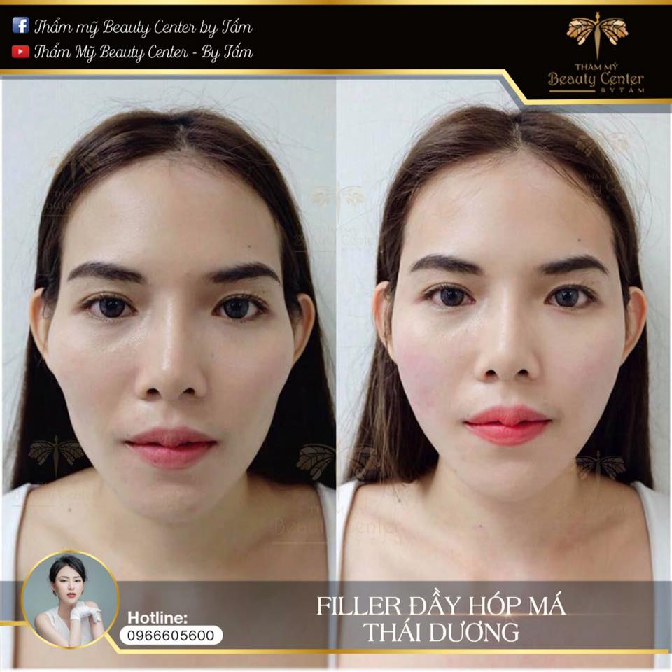 Kết thúc — quyết định thế nào để an toàn và hiệu quả?