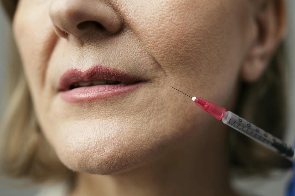 Quy trình an toàn nếu quyết định vẫn tiêm filler trước khi mang thai trong tương lai