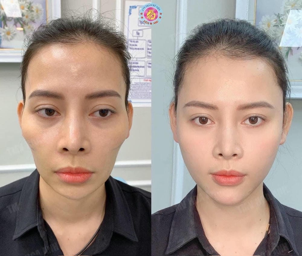 So sánh ngắn gọn theo mục tiêu