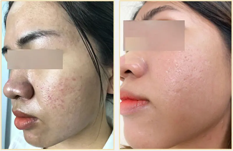 Muốn đi tiếp — cần chuẩn bị gì khi đến tư vấn tại clinic?