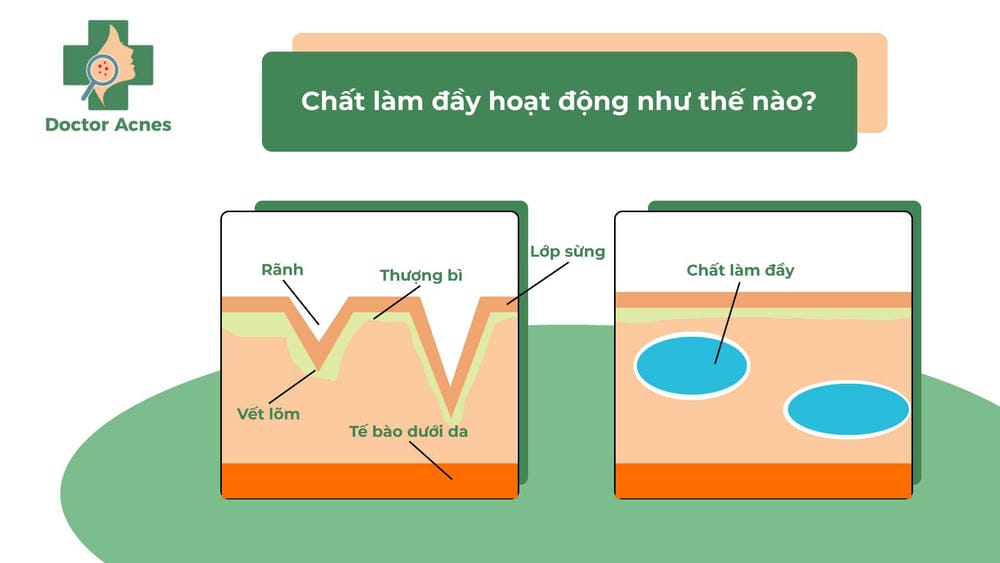 Lưu ý chăm sóc sau tiêm và khoảng cách giữa các liệu trình