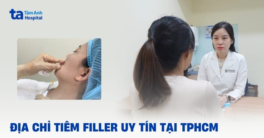 Filler Vivacy, Opera, Aileene có tốt không — nên chọn loại nào?