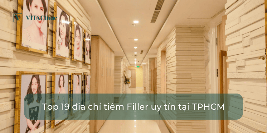 Chi phí và điều chỉnh kỳ vọng