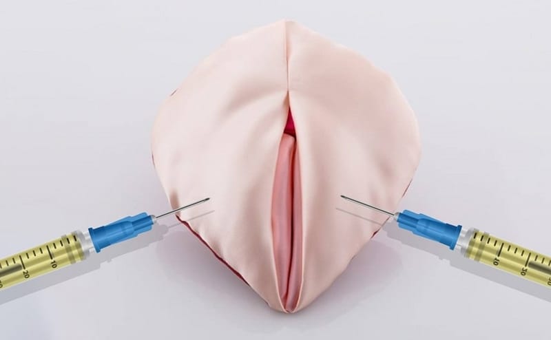 Tiêm vùng kín khác gì tiêm mặt — điểm then chốt