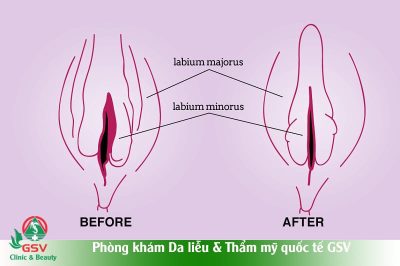 Lưu ý chăm sóc sau tiêm và dấu hiệu theo dõi