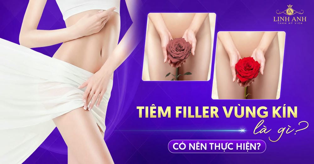 Biến chứng filler và xử trí cơ bản