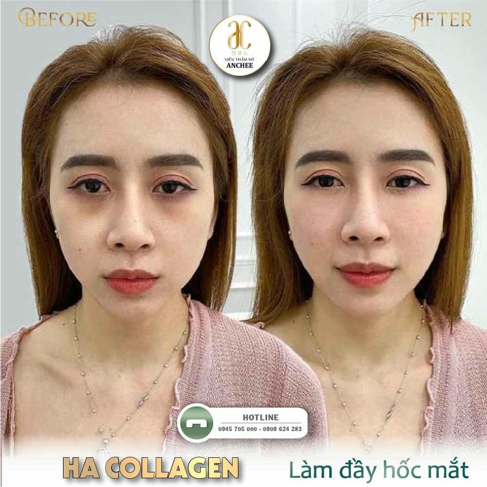 Những câu hỏi thường gặp