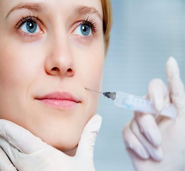 Các loại filler nên cân nhắc tại Việt Nam — ưu tiên và lưu ý nguồn gốc