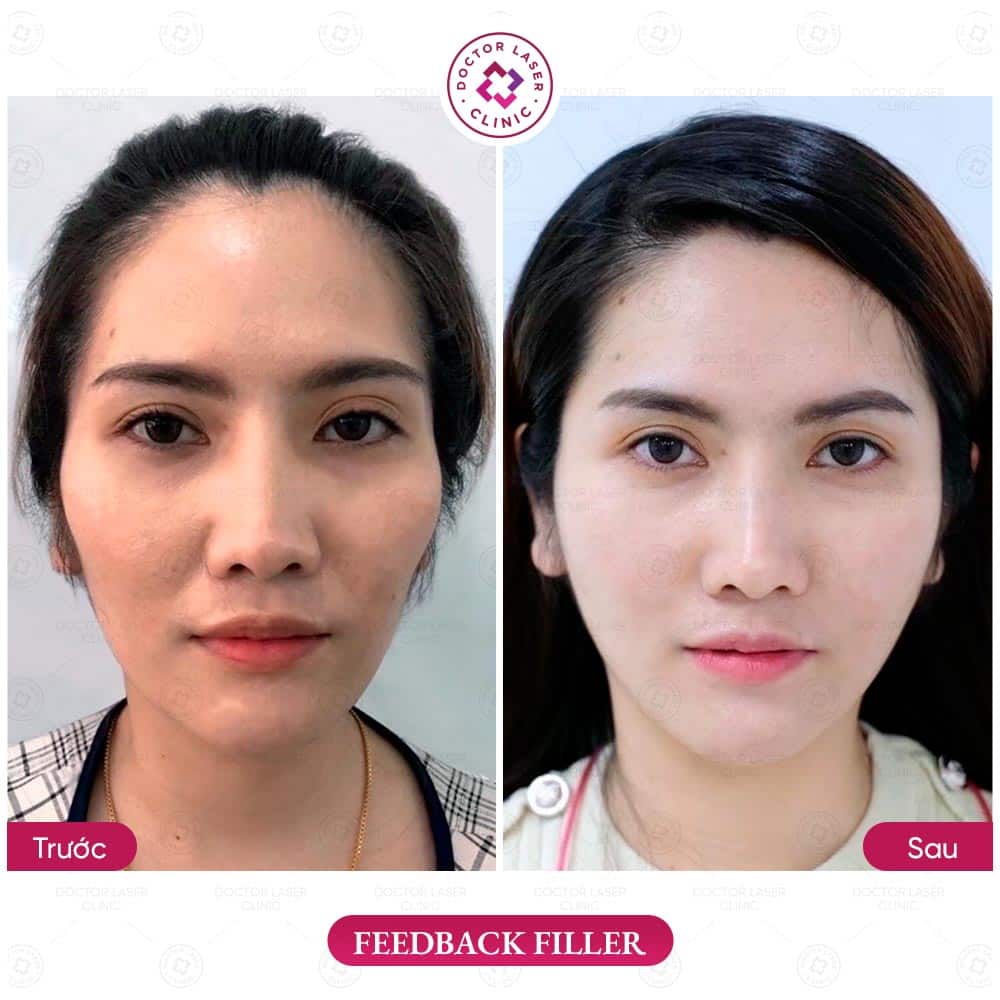 Chọn sản phẩm dựa trên mục tiêu thẩm mỹ