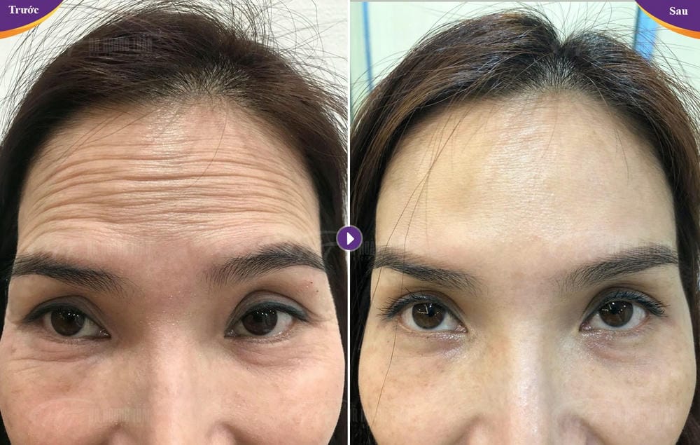 Những câu hỏi thường gặp mà khách hàng quan tâm
