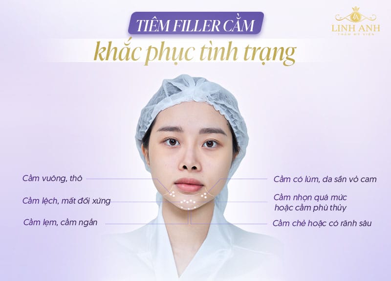 Tại sao cùng là "tiêm filler cằm" nhưng giá chênh nhau lớn — yếu tố nào quyết định?