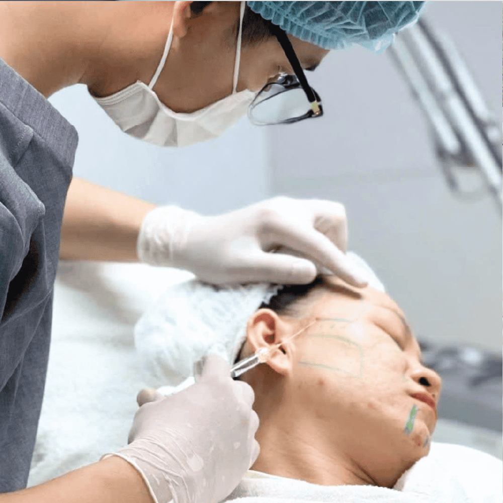 Những câu hỏi thường gặp người hay tự hỏi trước khi chọn "tiêm filler ở đâu"?
