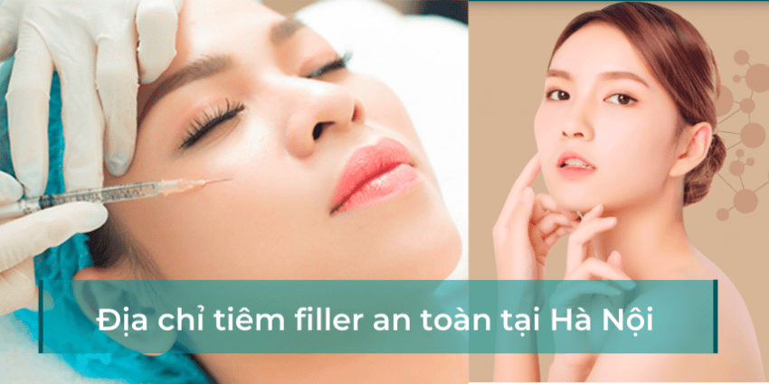 Loại filler nào an toàn và nên dùng loại gì — Vivacy, Opera, Aileene có gì khác nhau?