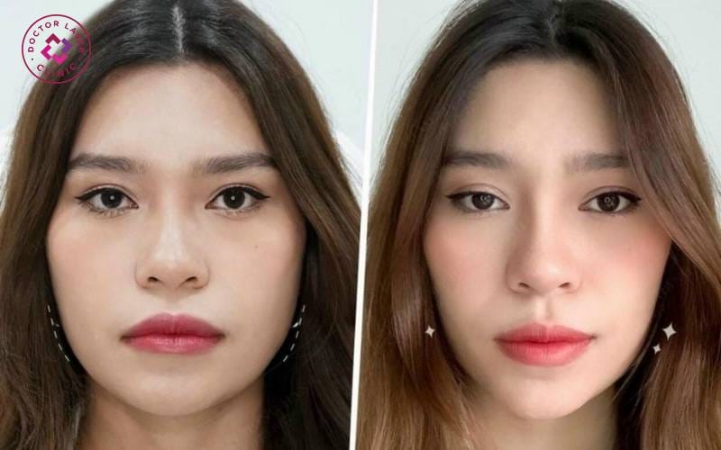 Quy trình an toàn tại clinic chuẩn y tế