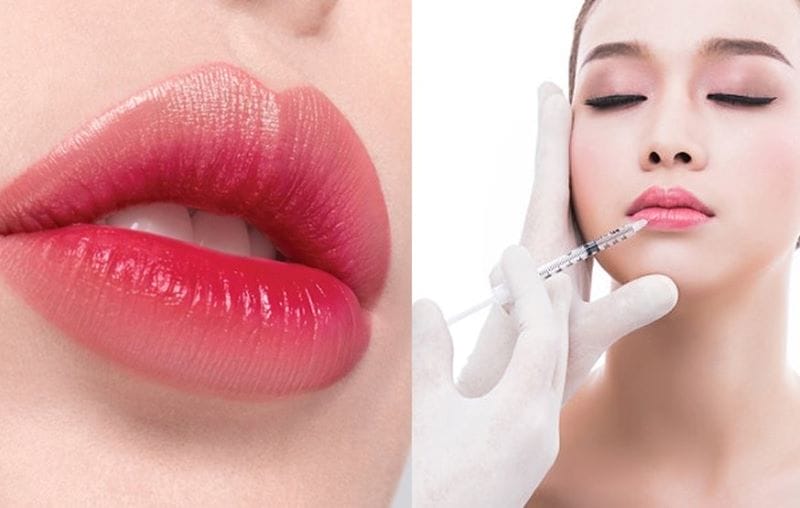 Những rủi ro và biến chứng thường gặp — có thể xảy ra gì?