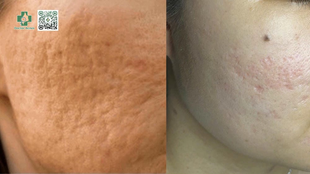 Các bằng chứng lâm sàng và tài liệu chuyên môn hỗ trợ Juvelook nói gì?