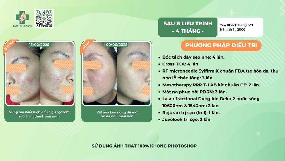 Quy trình tiêm Juvelook chuẩn tại phòng khám nên diễn ra như thế nào?