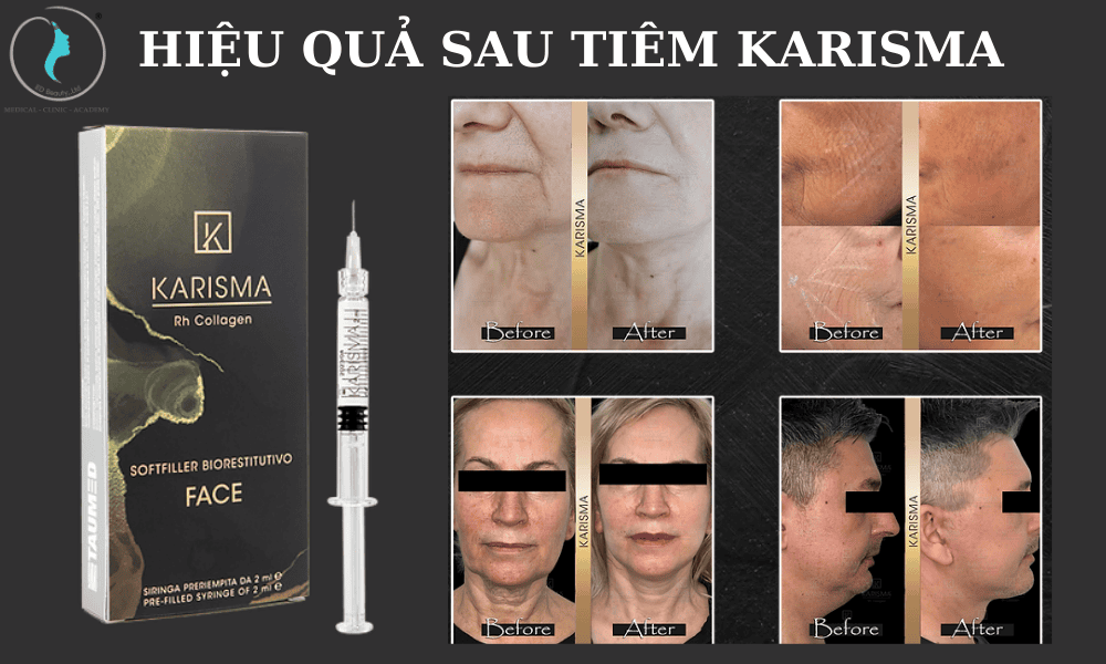 Ai phù hợp hoặc không phù hợp với Karisma?