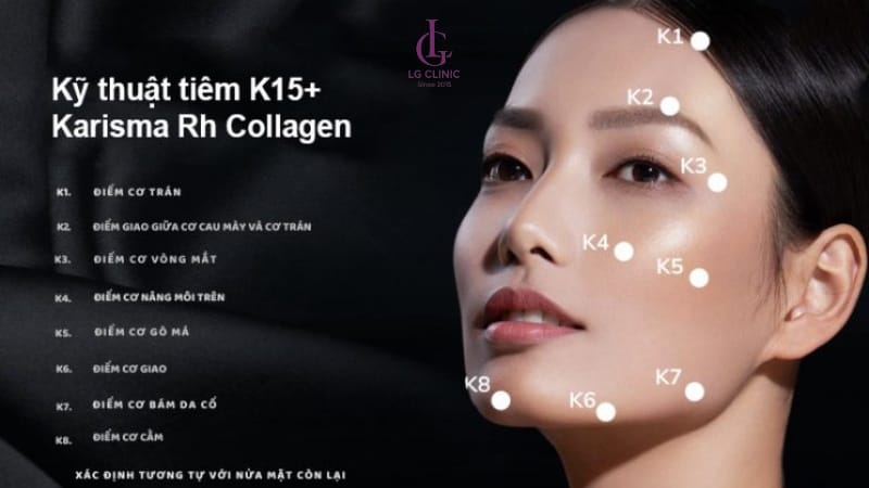 Tiêm Karisma ở đâu uy tín tại HCM, Hà Nội và Cần Thơ — những nơi được gợi ý và tiêu chí chọn