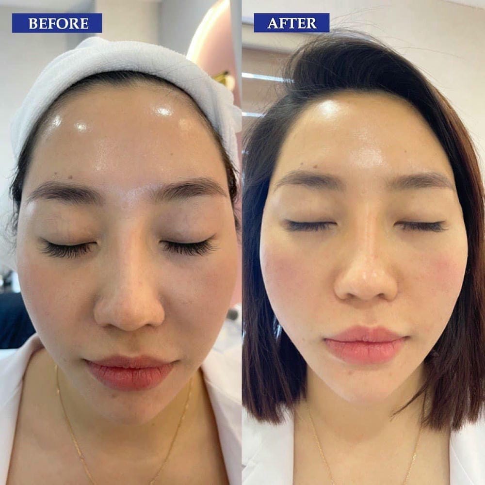 Tư vấn chuyên sâu tại Lona Skin Lab