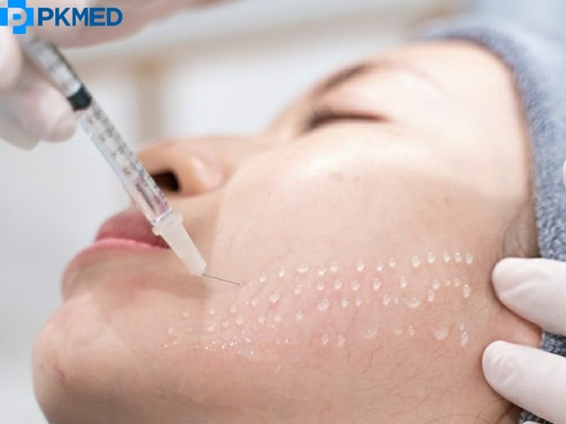 Ai không nên tiêm meso — các chống chỉ định và lưu ý thuốc?