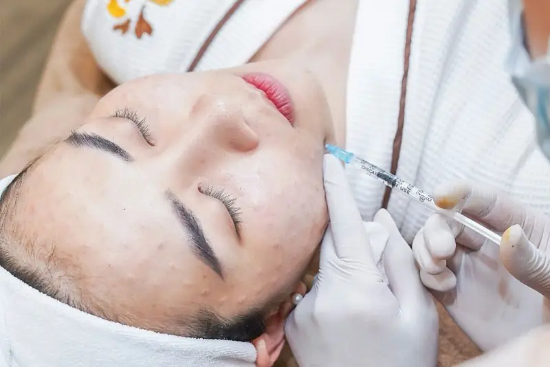 Bao lâu thì cảm giác đau, đỏ, bầm sau meso sẽ hết?