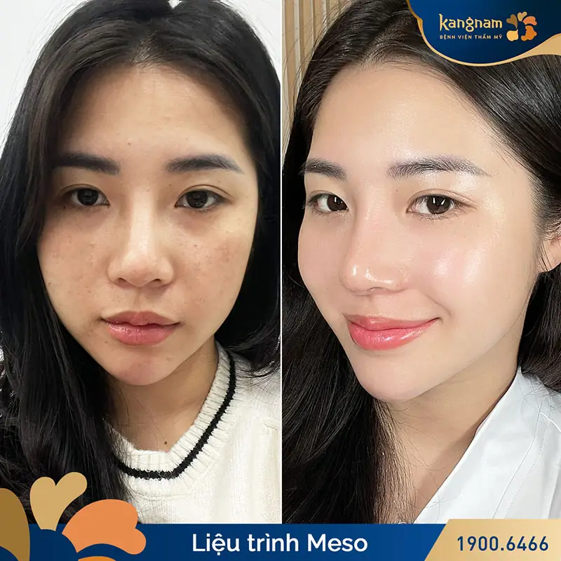 Tại sao một số người thấy kết quả nhanh hơn người khác?