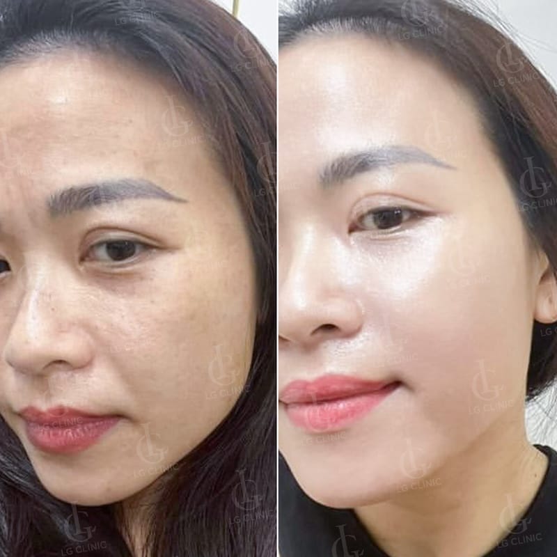 Những rủi ro và đối tượng không phù hợp — cần thận trọng điều gì?