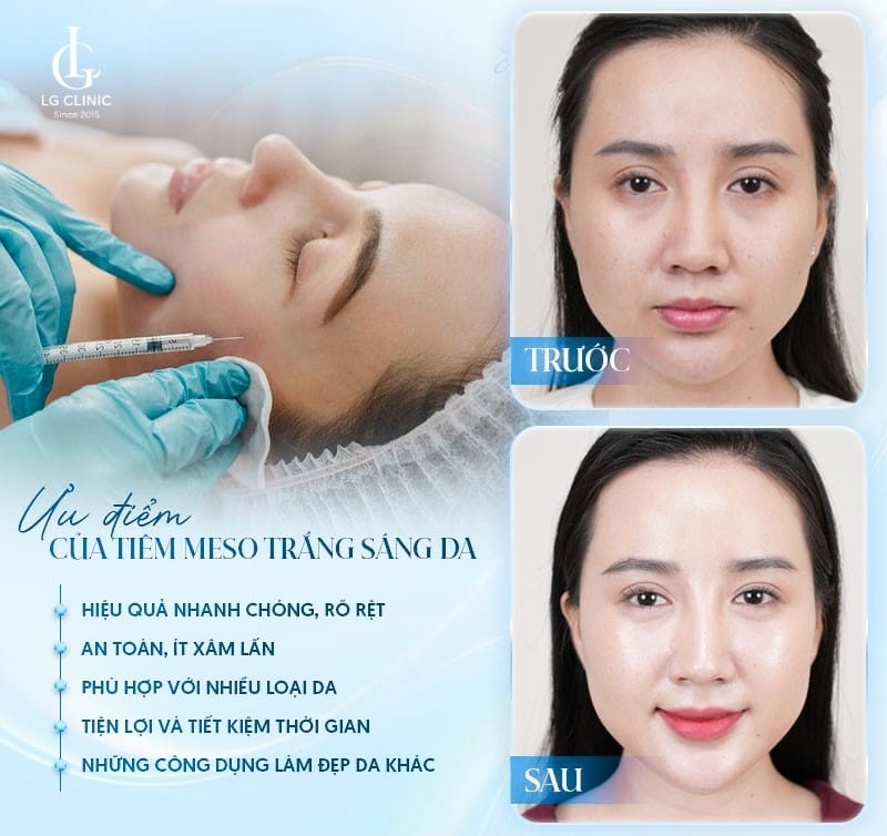Quy trình tiêm meso trắng da mặt và chăm sóc sau tiêm diễn ra như thế nào?