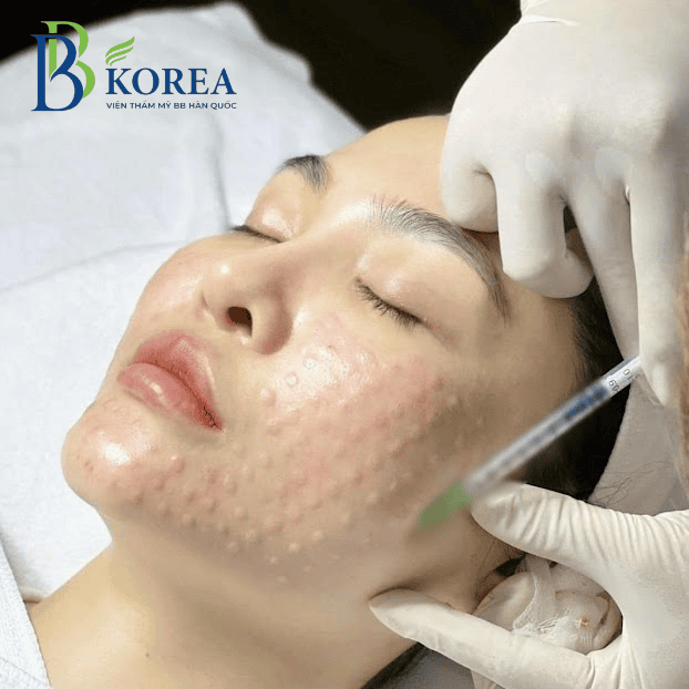 So sánh chi phí với phương pháp khác