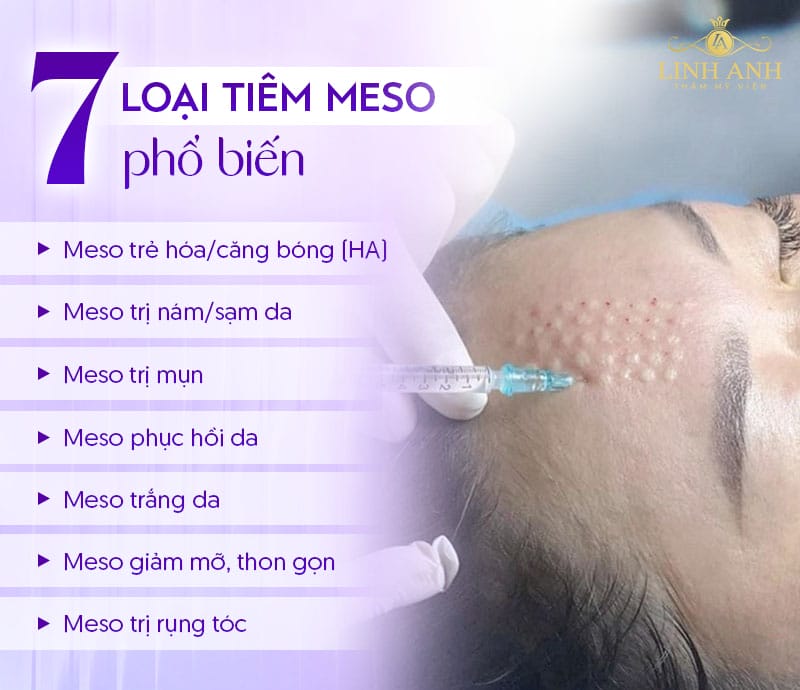 Cách tối ưu chi phí mà vẫn hiệu quả