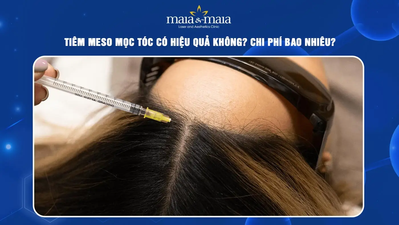 Ai phù hợp với tiêm meso tóc và ai không nên làm?