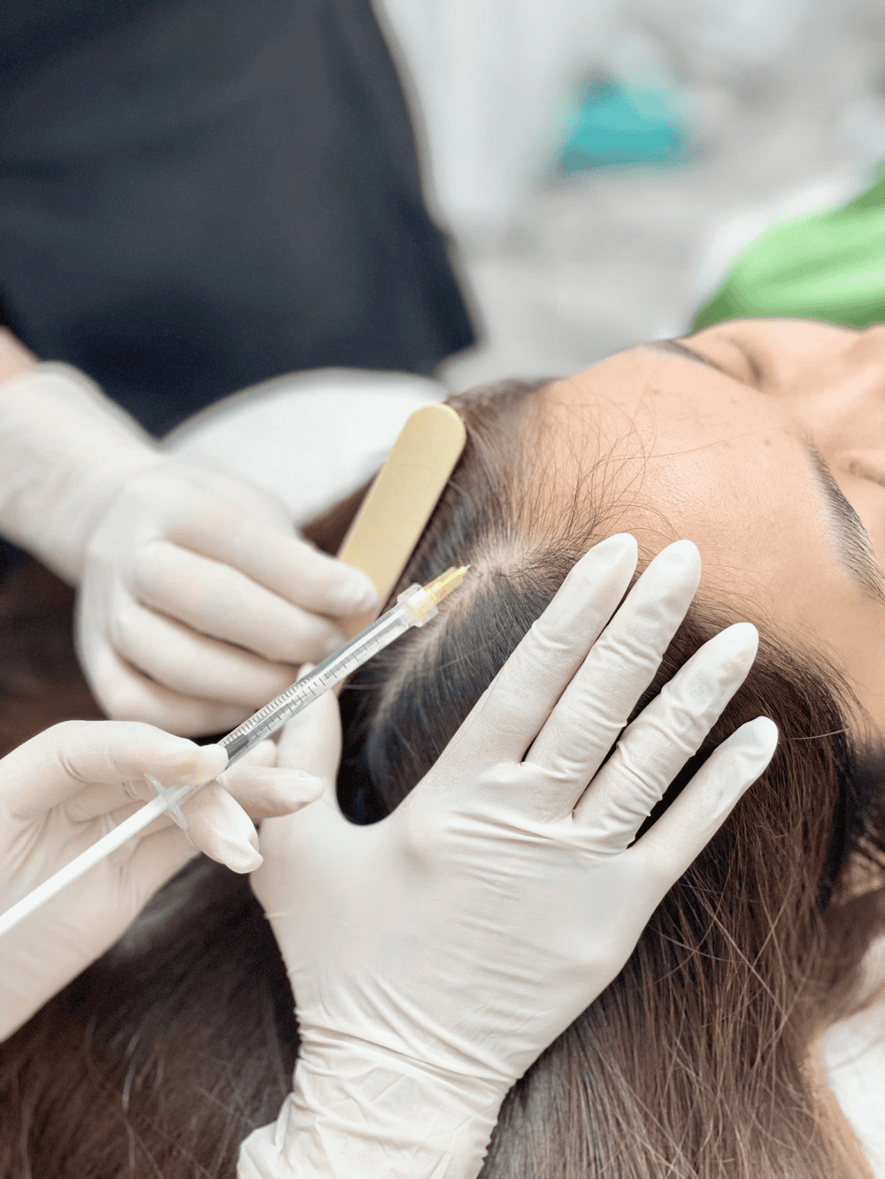 Làm sao để giảm rủi ro và chọn nơi tiêm meso tóc an toàn?