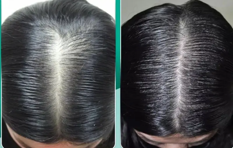 Bao lâu mới thấy kết quả và nên kỳ vọng điều gì thực tế?