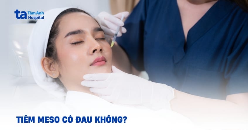 Tại sao tiêm meso có thể đau? Cơ chế và yếu tố ảnh hưởng là gì?
