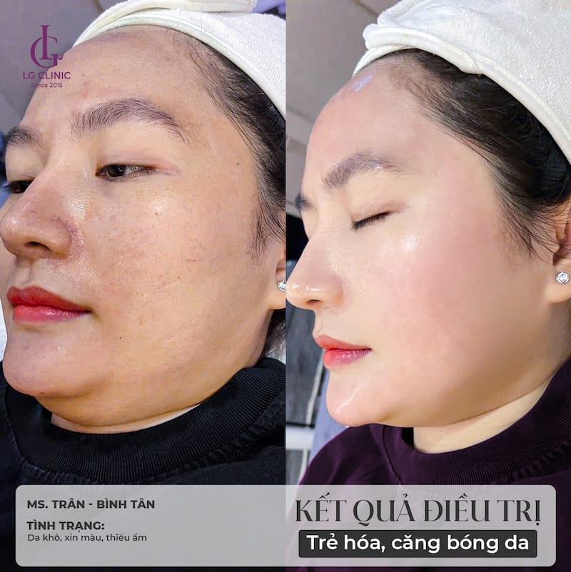 Ở HCM, Hà Nội và Cần Thơ: những cơ sở nên cân nhắc là gì?