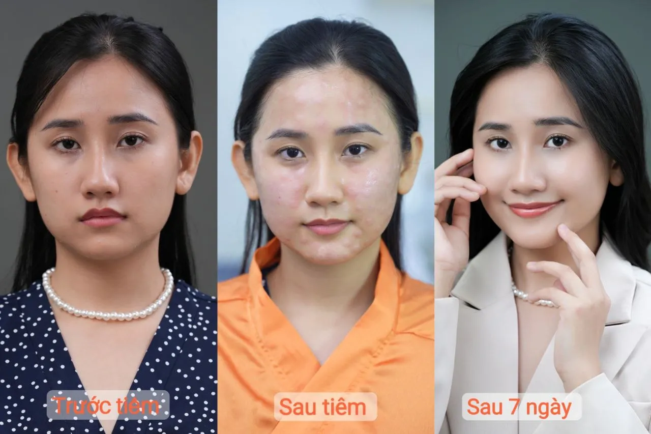 Khi không nên tự làm hoặc tiêm tại nhà