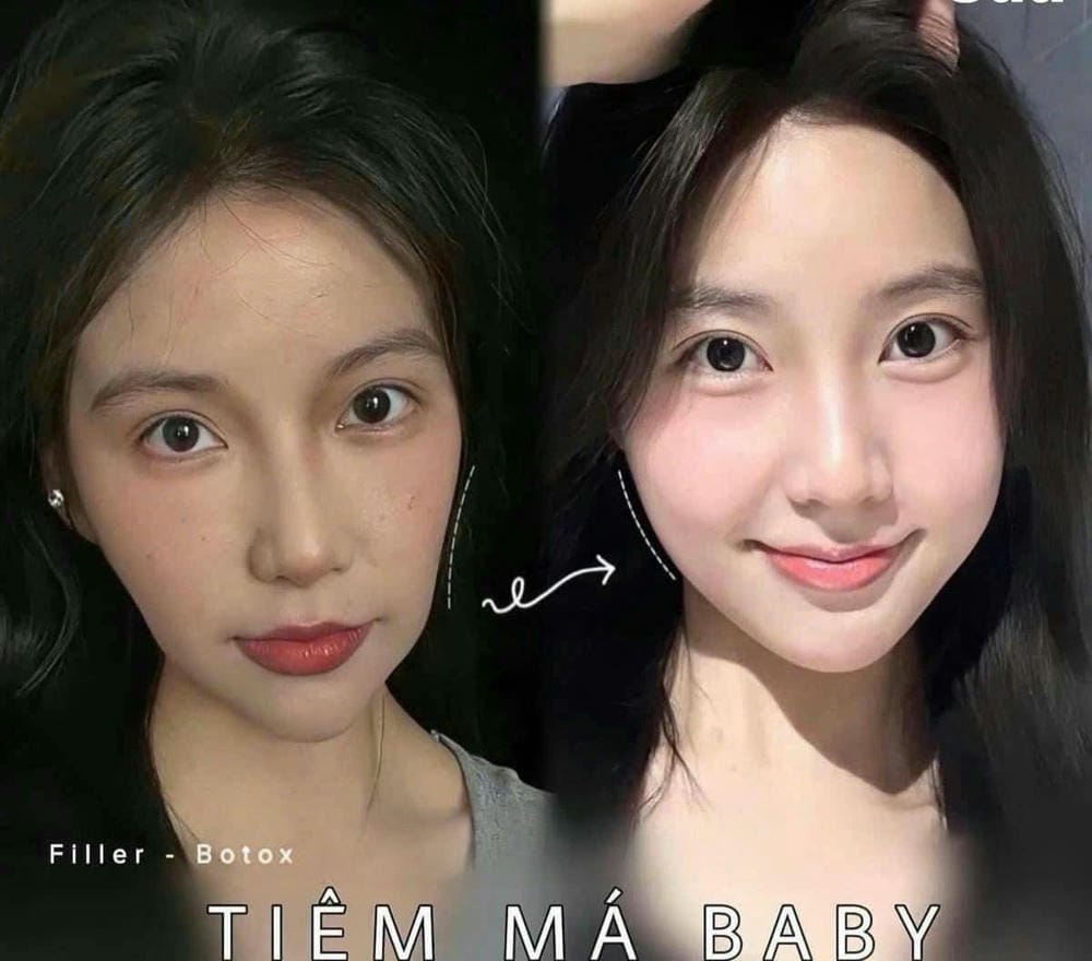 Cách chọn nơi tiêm an toàn và phù hợp