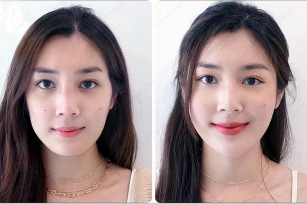 Lựa chọn nơi thực hiện: Tiêu chí để tránh rủi ro khi bị "vĩnh viễn" hóa kết quả