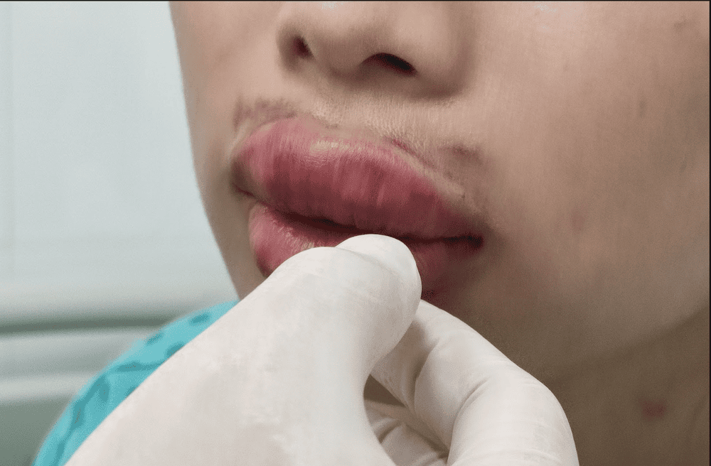 2. Uống arnica có thực sự giúp bớt bầm?