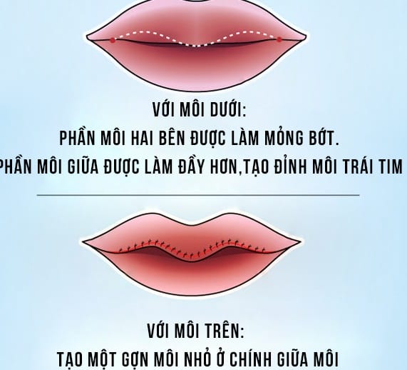 Có những phương pháp giảm đau nào — cách nào hiệu quả nhất?