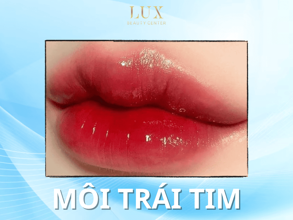 Tiêm môi dày có phù hợp với mọi người không?