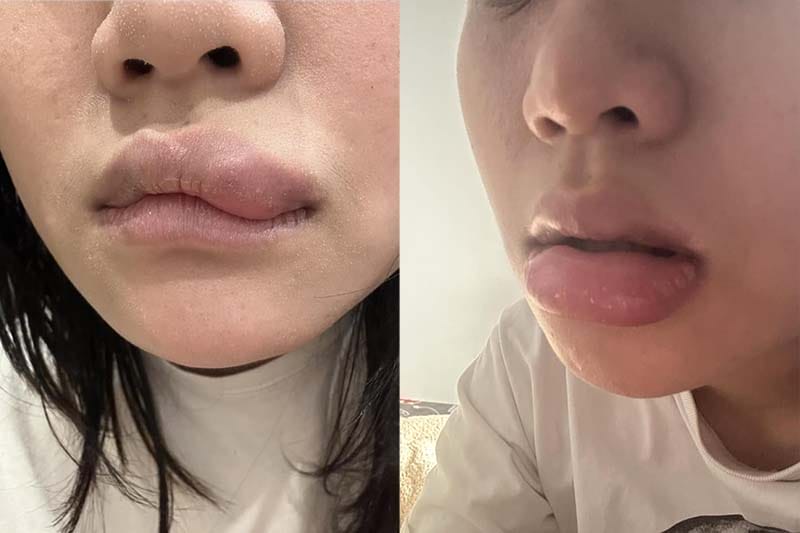 Những câu hỏi thường gặp khách hàng hay băn khoăn