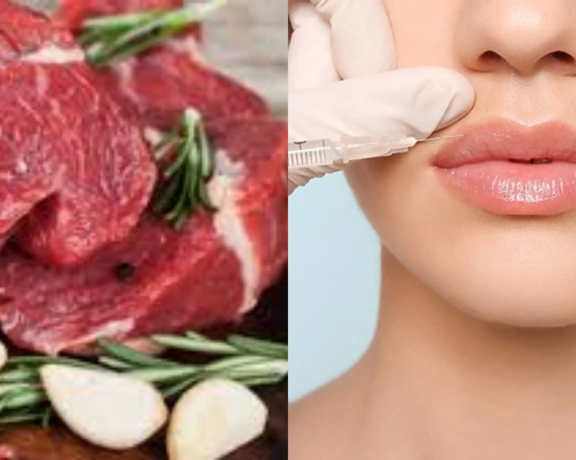 Tại sao một số thực phẩm và thuốc làm ảnh hưởng đến kết quả sau tiêm filler?